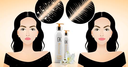 Anti-Dandruff Shampoo